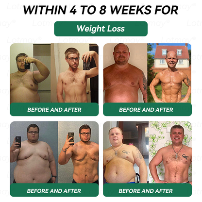 𝑶𝒇𝒇𝒊𝒄𝒊𝒂𝒍 𝑺𝒕𝒐𝒓𝒆 | 𝑳𝒐𝒕𝒎𝒂𝒚®⚡𝑮𝑳𝑷-1 & 𝑵𝑨𝑫+𝑾𝒆𝒊𝒈𝒉𝒕 𝑳𝒐𝒔𝒔 & 𝑭𝒊𝒓𝒎𝒊𝒏𝒈 𝑶𝒓𝒂𝒍 𝑺𝒐𝒍𝒖𝒕𝒊𝒐𝒏