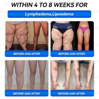 𝑲𝒆𝒚𝒆𝒔𝒔®💎𝑮𝑳𝑷-1 𝑷𝒓𝒐𝒃𝒊𝒐𝒕𝒊𝒄 𝑭𝒖𝒍𝒍-𝑩𝒐𝒅𝒚 𝑺𝒄𝒖𝒍𝒑𝒕𝒊𝒏𝒈 & 𝑯𝒆𝒂𝒍𝒕𝒉 𝑩𝒐𝒐𝒔𝒕 𝑳𝒊𝒕𝒕𝒍𝒆 𝑩𝒍𝒖𝒆 𝑱𝒂𝒓