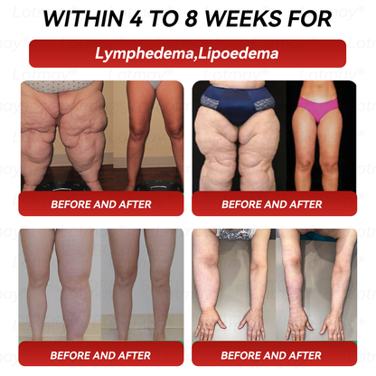 𝑶𝒇𝒇𝒊𝒄𝒊𝒂𝒍 𝑺𝒕𝒐𝒓𝒆 | 𝑳𝒐𝒕𝑚𝒂𝑦®⚡𝐺𝑳𝑷-1 & 𝑵𝑨𝑫+ 𝑆𝑖𝑥-𝑖𝒏-𝑶𝒏𝒆 𝑾𝒆𝒊𝒈𝒉𝒕 𝑳𝒐𝒔𝒔 & 𝑭𝒊𝒓𝒎𝒊𝒏𝒈 𝑶𝒓𝒂𝒍 𝑺𝒐𝒍𝒖𝒕𝒊𝒐𝒏 (𝑶𝒏𝒄𝒆 𝒅𝒂𝒊𝒍𝒚 – 𝒗𝒊𝒔𝒊𝒃𝒍𝒆 𝒄𝒉𝒂𝒏𝒈𝒆𝒔 𝒘𝒊𝒕𝒉𝒊𝒏 7 𝒅𝒂𝒚𝒔) 𝑭𝒐𝒓 𝒎𝒆𝒕𝒂𝒃𝒐𝒍𝒊𝒔𝒎, 𝒇𝒂𝒕 𝒍𝒐𝒔𝒔, 𝒔𝒌𝒊𝒏 𝒇𝒊𝒓𝒎𝒏𝒆𝒔𝒔, 𝒃𝒍𝒐𝒐𝒅 𝒔𝒖𝒈𝒂𝒓 𝒃𝒂𝒍𝒂𝒏𝒄𝒆, 𝒋𝒐𝒊𝒏𝒕 𝒄𝒐𝒎𝒇𝒐𝒓𝒕, 𝒂𝒏𝒅 𝒎𝒐𝒓𝒆