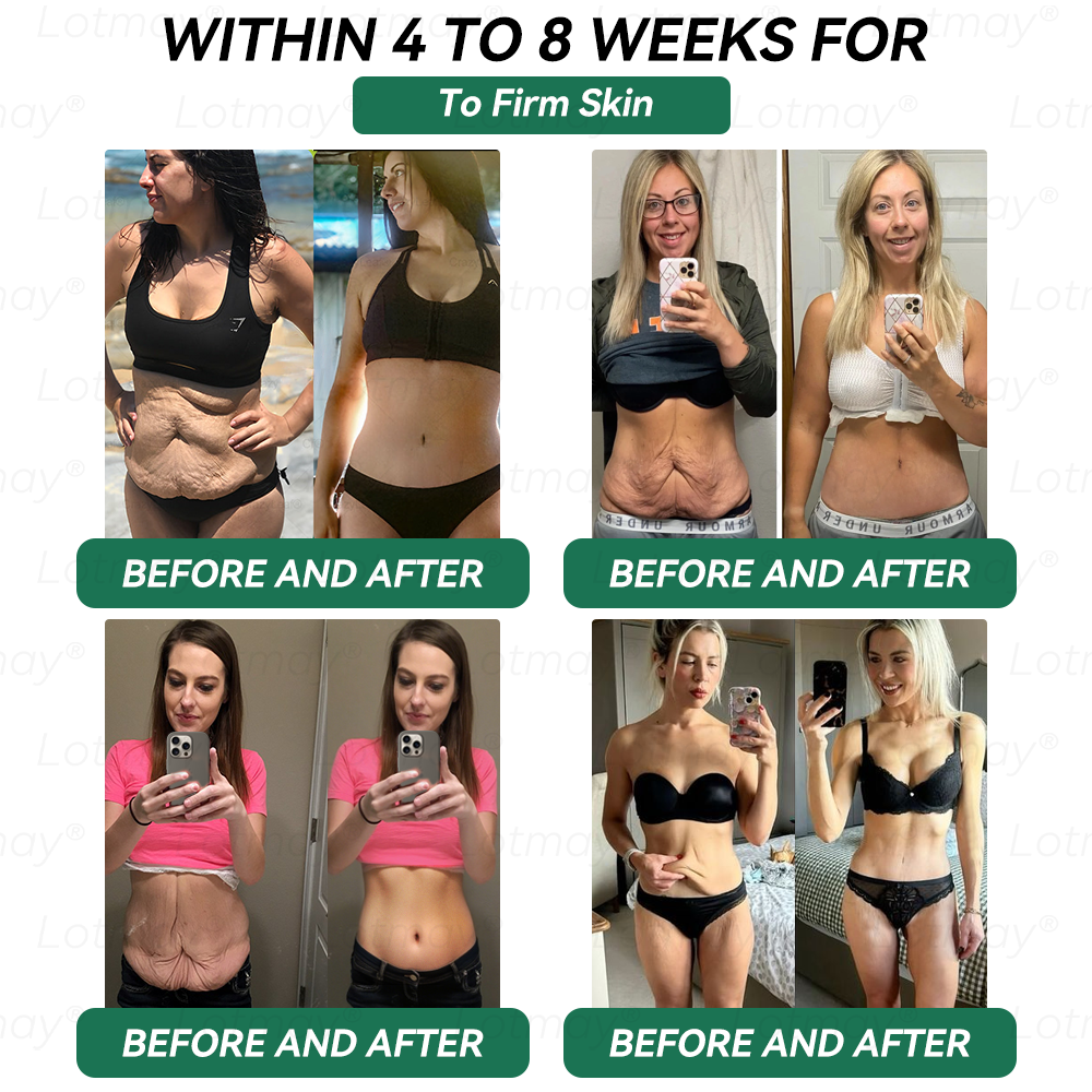 𝑶𝒇𝒇𝒊𝒄𝒊𝒂𝒍 𝑺𝒕𝒐𝒓𝒆 | 𝑳𝒐𝒕𝒎𝒂𝒚®⚡𝑮𝑳𝑷-1 & 𝑵𝑨𝑫+𝑾𝒆𝒊𝒈𝒉𝒕 𝑳𝒐𝒔𝒔 & 𝑭𝒊𝒓𝒎𝒊𝒏𝒈 𝑶𝒓𝒂𝒍 𝑺𝒐𝒍𝒖𝒕𝒊𝒐𝒏