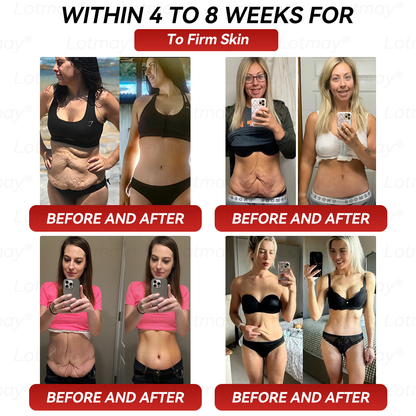 𝑶𝒇𝒇𝒊𝒄𝒊𝒂𝒍 𝑺𝒕𝒐𝒓𝒆 | 𝑳𝒐𝒕𝑚𝒂𝑦®⚡𝐺𝑳𝑷-1 & 𝑵𝑨𝑫+ 𝑆𝑖𝑥-𝑖𝒏-𝑶𝒏𝒆 𝑾𝒆𝒊𝒈𝒉𝒕 𝑳𝒐𝒔𝒔 & 𝑭𝒊𝒓𝒎𝒊𝒏𝒈 𝑶𝒓𝒂𝒍 𝑺𝒐𝒍𝒖𝒕𝒊𝒐𝒏 (𝑶𝒏𝒄𝒆 𝒅𝒂𝒊𝒍𝒚 – 𝒗𝒊𝒔𝒊𝒃𝒍𝒆 𝒄𝒉𝒂𝒏𝒈𝒆𝒔 𝒘𝒊𝒕𝒉𝒊𝒏 7 𝒅𝒂𝒚𝒔) 𝑭𝒐𝒓 𝒎𝒆𝒕𝒂𝒃𝒐𝒍𝒊𝒔𝒎, 𝒇𝒂𝒕 𝒍𝒐𝒔𝒔, 𝒔𝒌𝒊𝒏 𝒇𝒊𝒓𝒎𝒏𝒆𝒔𝒔, 𝒃𝒍𝒐𝒐𝒅 𝒔𝒖𝒈𝒂𝒓 𝒃𝒂𝒍𝒂𝒏𝒄𝒆, 𝒋𝒐𝒊𝒏𝒕 𝒄𝒐𝒎𝒇𝒐𝒓𝒕, 𝒂𝒏𝒅 𝒎𝒐𝒓𝒆