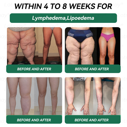 𝑶𝒇𝒇𝒊𝒄𝒊𝒂𝒍 𝑺𝒕𝒐𝒓𝒆 | 𝑳𝒐𝒕𝒎𝒂𝒚®⚡𝑮𝑳𝑷-1 & 𝑵𝑨𝑫+𝑾𝒆𝒊𝒈𝒉𝒕 𝑳𝒐𝒔𝒔 & 𝑭𝒊𝒓𝒎𝒊𝒏𝒈 𝑶𝒓𝒂𝒍 𝑺𝒐𝒍𝒖𝒕𝒊𝒐𝒏