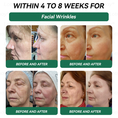 𝑶𝒇𝒇𝒊𝒄𝒊𝒂𝒍 𝑺𝒕𝒐𝒓𝒆 | 𝑳𝒐𝒕𝒎𝒂𝒚®⚡𝑮𝑳𝑷-1 & 𝑵𝑨𝑫+𝑾𝒆𝒊𝒈𝒉𝒕 𝑳𝒐𝒔𝒔 & 𝑭𝒊𝒓𝒎𝒊𝒏𝒈 𝑶𝒓𝒂𝒍 𝑺𝒐𝒍𝒖𝒕𝒊𝒐𝒏