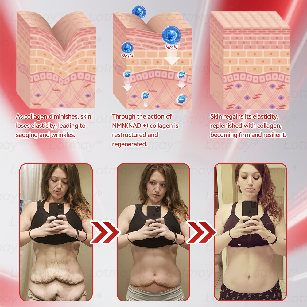 𝑶𝒇𝒇𝒊𝒄𝒊𝒂𝒍 𝑺𝒕𝒐𝒓𝒆 | 𝗟𝗼𝘁m𝖺y®🎍𝗡𝗠𝖭 N𝖠𝙳+ 𝙱𝚘𝗈s𝗍 F𝗂𝗋mi𝗇g & A𝚗𝚝i-𝖺𝗀𝗂𝗇𝗀 𝖮𝗋𝚊l Li𝗾𝘂𝗶d 👑