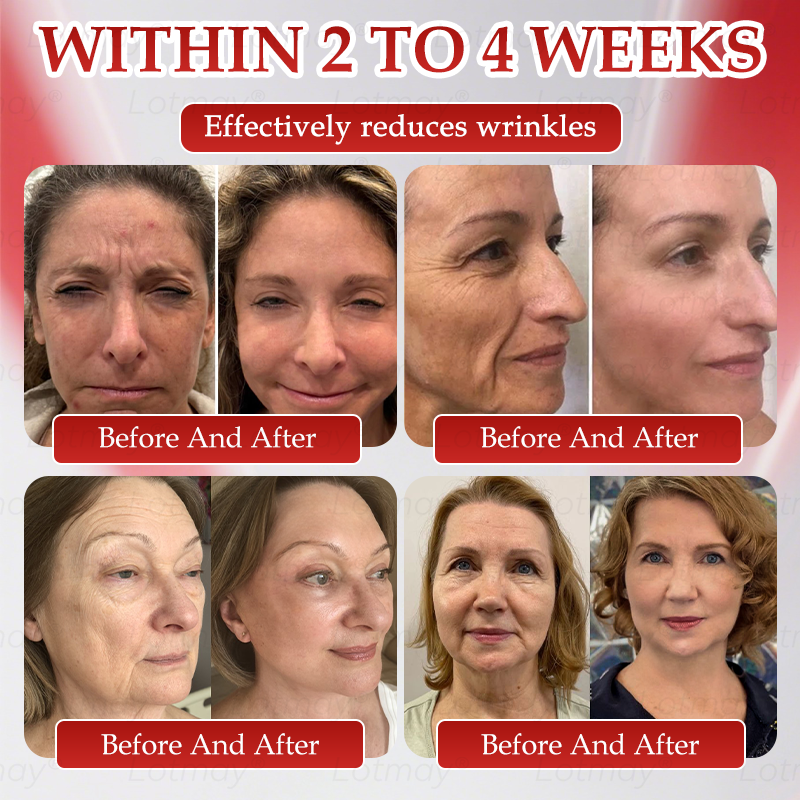 𝑶𝒇𝒇𝒊𝒄𝒊𝒂𝒍 𝑺𝒕𝒐𝒓𝒆 | 𝗟𝗼𝘁m𝖺y®🎍𝗡𝗠𝖭 N𝖠𝙳+ 𝙱𝚘𝗈s𝗍 F𝗂𝗋mi𝗇g & A𝚗𝚝i-𝖺𝗀𝗂𝗇𝗀 𝖮𝗋𝚊l Li𝗾𝘂𝗶d 👑