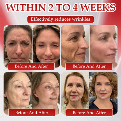 𝑶𝒇𝒇𝒊𝒄𝒊𝒂𝒍 𝑺𝒕𝒐𝒓𝒆 | 𝗟𝗼𝘁m𝖺y®🎍𝗡𝗠𝖭 N𝖠𝙳+ 𝙱𝚘𝗈s𝗍 F𝗂𝗋mi𝗇g & A𝚗𝚝i-𝖺𝗀𝗂𝗇𝗀 𝖮𝗋𝚊l Li𝗾𝘂𝗶d 👑