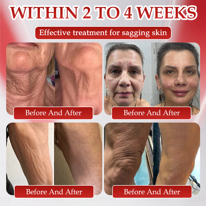 𝑶𝒇𝒇𝒊𝒄𝒊𝒂𝒍 𝑺𝒕𝒐𝒓𝒆 | 𝗟𝗼𝘁m𝖺y®🎍𝗡𝗠𝖭 N𝖠𝙳+ 𝙱𝚘𝗈s𝗍 F𝗂𝗋mi𝗇g & A𝚗𝚝i-𝖺𝗀𝗂𝗇𝗀 𝖮𝗋𝚊l Li𝗾𝘂𝗶d 👑