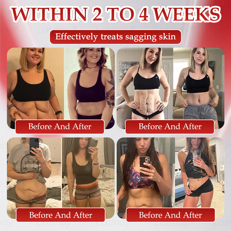 𝑶𝒇𝒇𝒊𝒄𝒊𝒂𝒍 𝑺𝒕𝒐𝒓𝒆 | 𝗟𝗼𝘁m𝖺y®🎍𝗡𝗠𝖭 N𝖠𝙳+ 𝙱𝚘𝗈s𝗍 F𝗂𝗋mi𝗇g & A𝚗𝚝i-𝖺𝗀𝗂𝗇𝗀 𝖮𝗋𝚊l Li𝗾𝘂𝗶d 👑